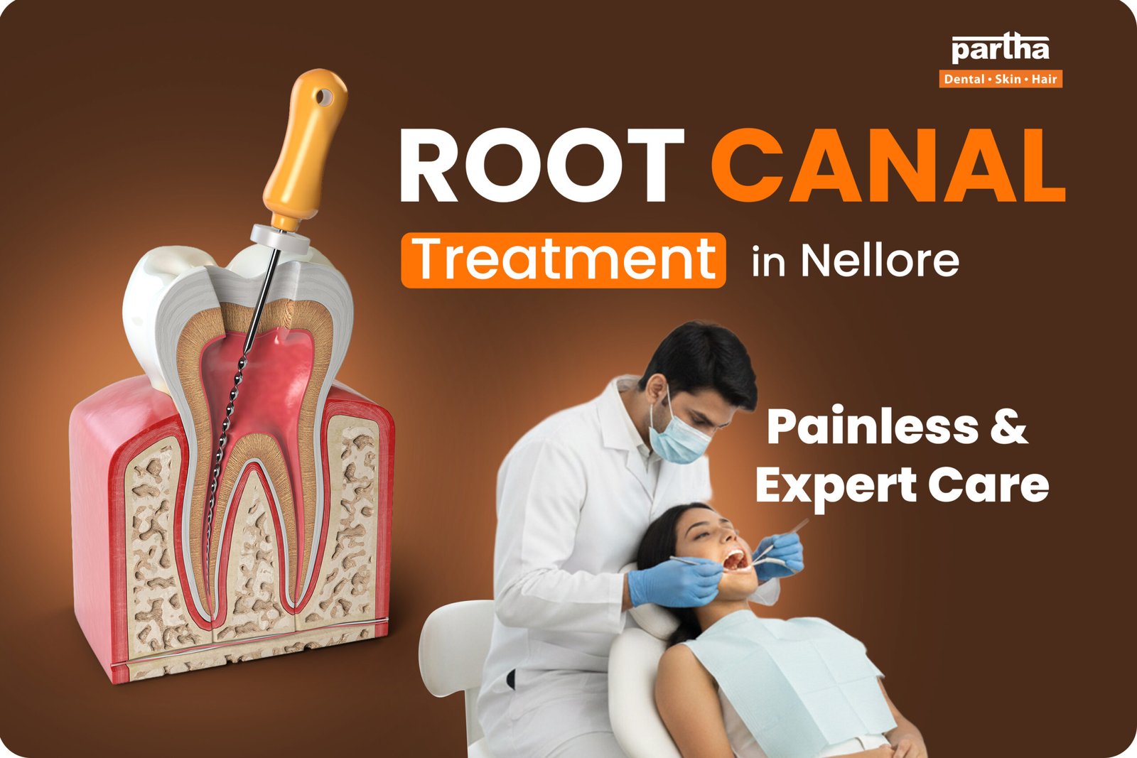 Root Canal Treatment in Nellore