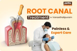 Root Canal Treatment in Vanasthalipuram
