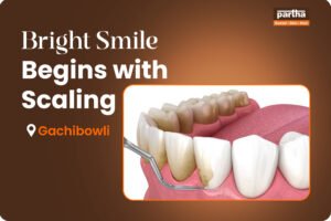 Teeth Cleaning - Gachibowli
