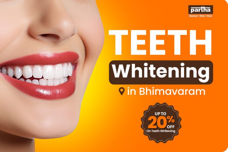Teeth Whitening Bhimavaram