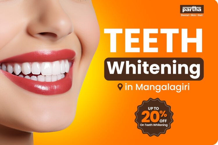 Teeth Whitening in Mangalagiri