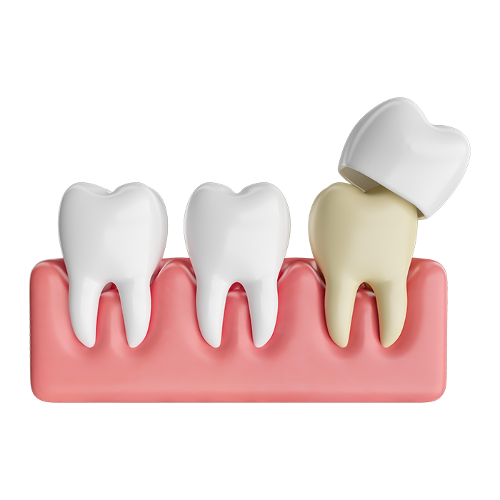 The Real Deal behind Myths about Dental Crowns 1