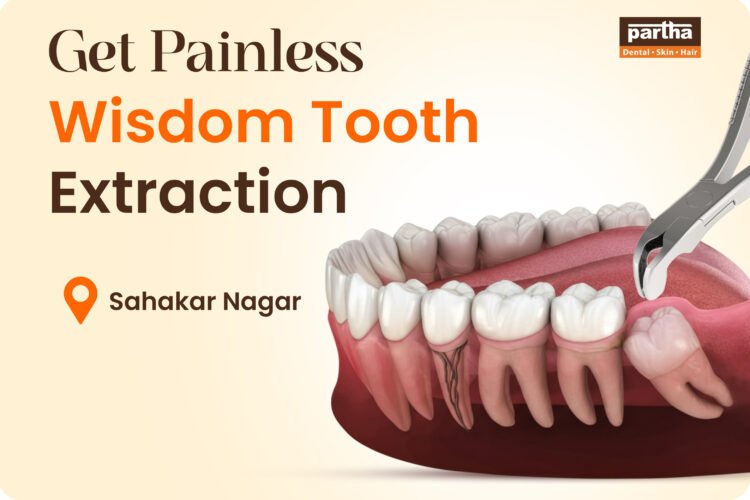 Wisdom Teeth Extraction