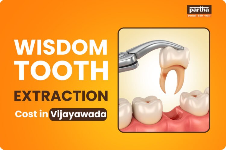 Wisdom-Tooth-Extraction-Cost-in-Vijayawada