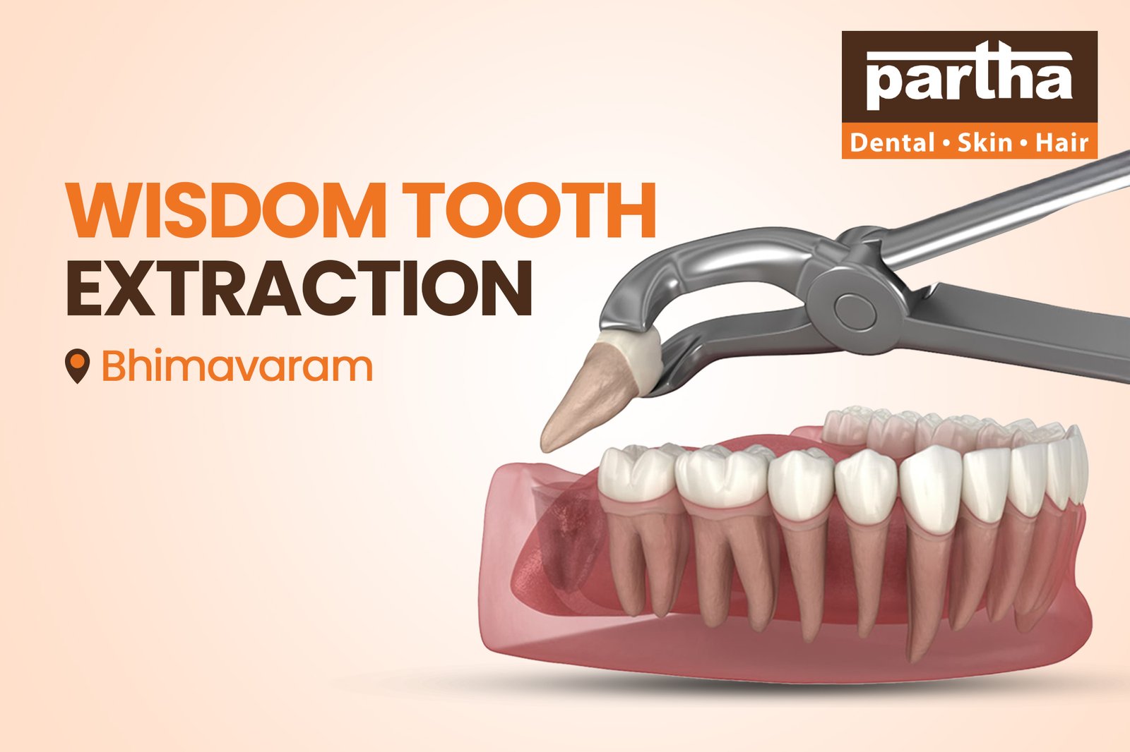 Wisdom Tooth Extraction Bhimavaram