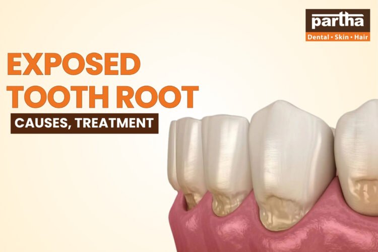 exposed tooth root