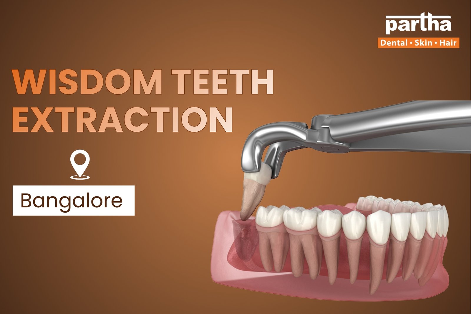 tooth extraction in bangalore