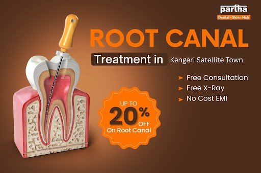Root Canal treatment in kengeri satellite