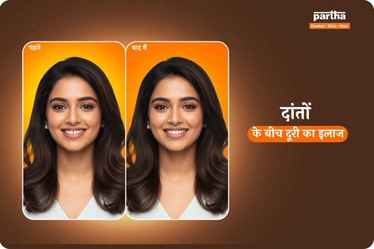 दांतों के बीच दूरी का इलाज 1