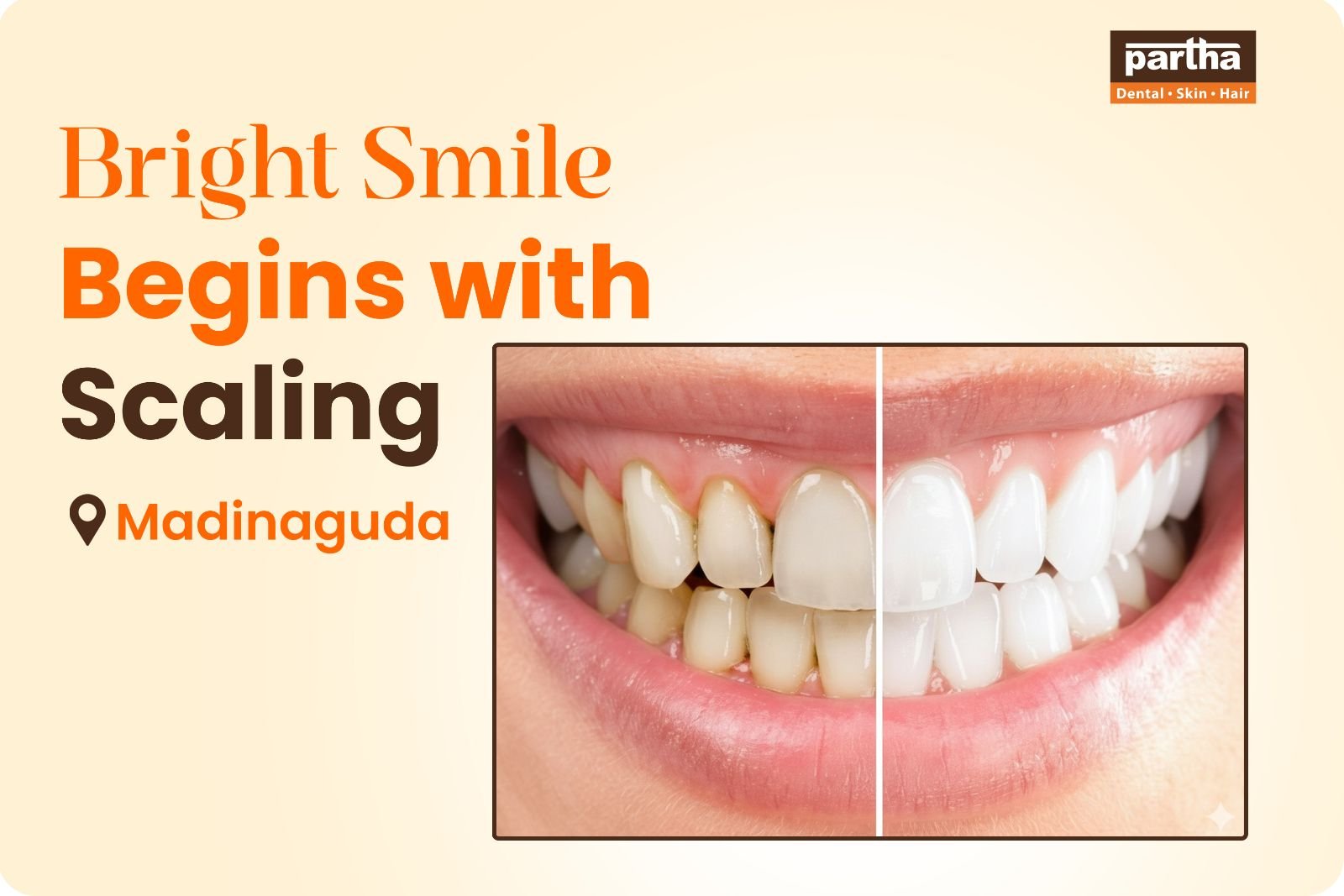 teeth-scaling-madinaguda