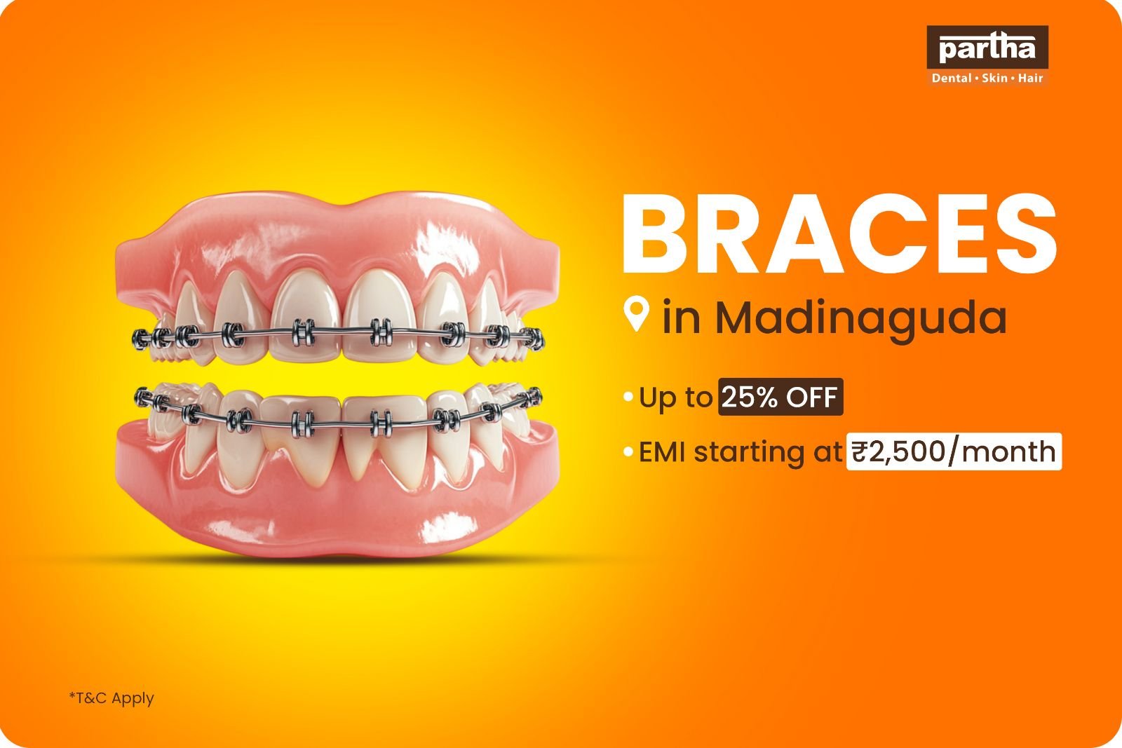 braces-madinaguda