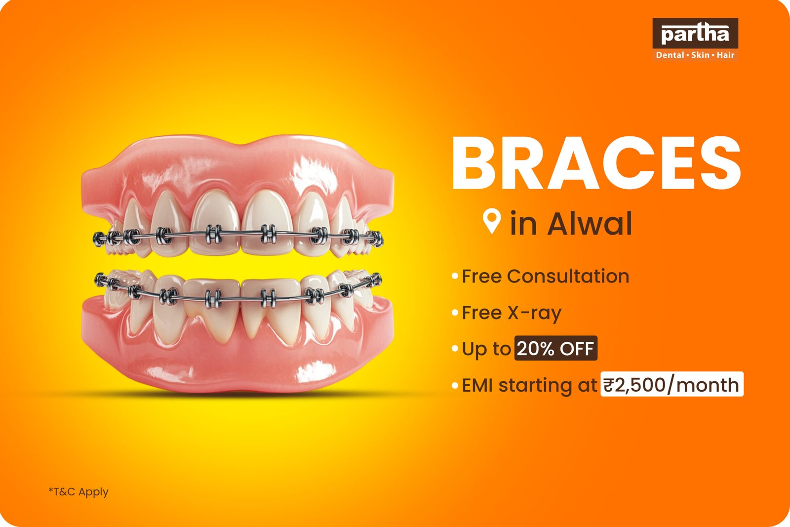 Braces -Alwal