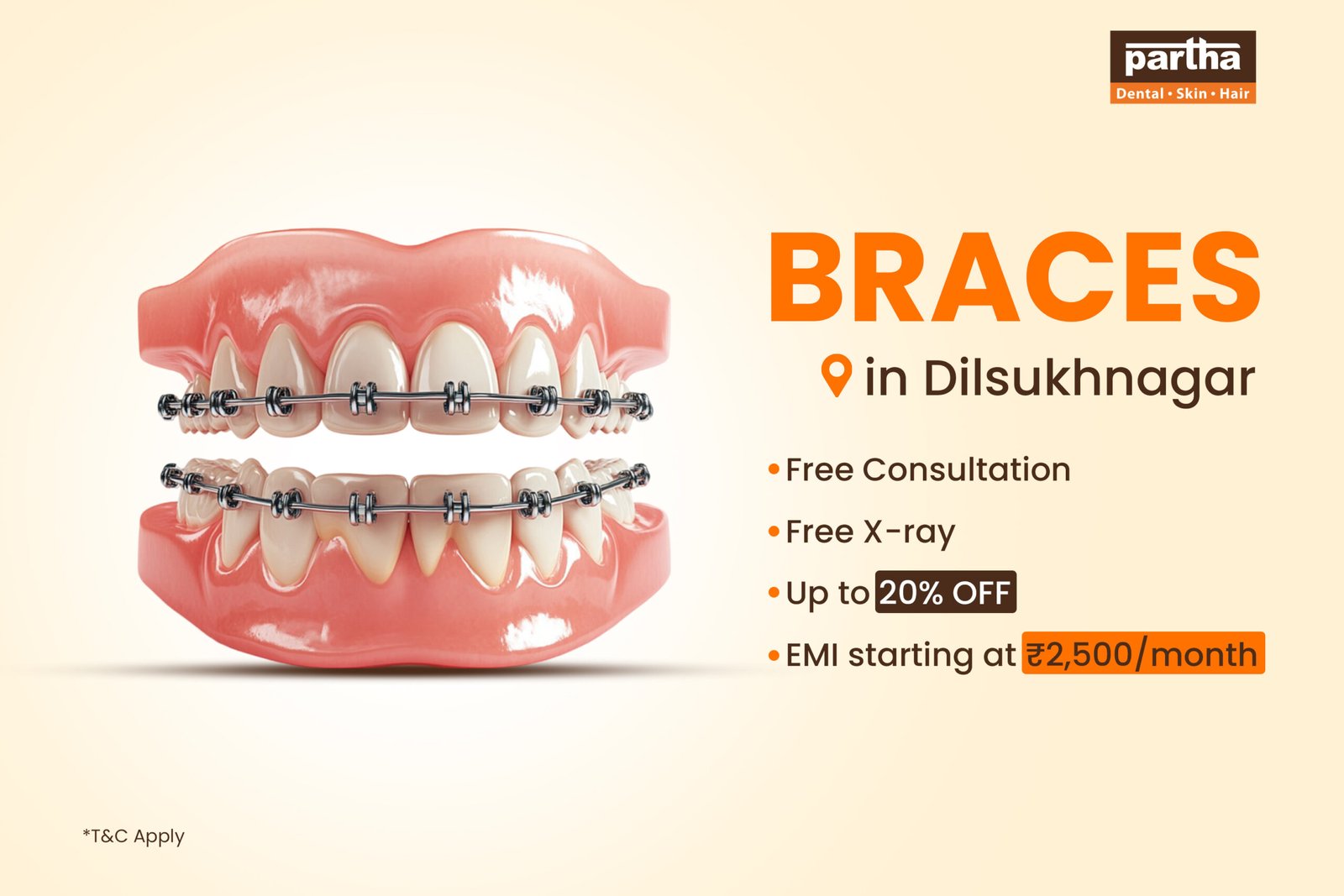 Braces -Dilsukhnagar