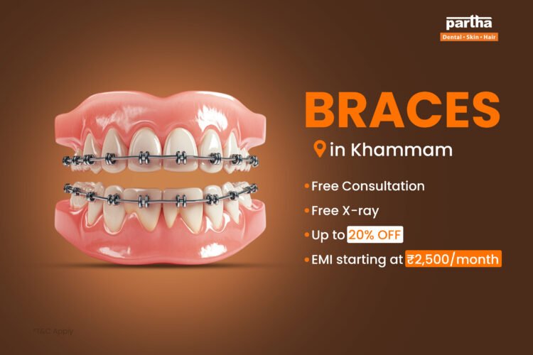 Braces Khammam