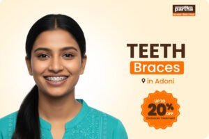 Dental Braces - Adoni