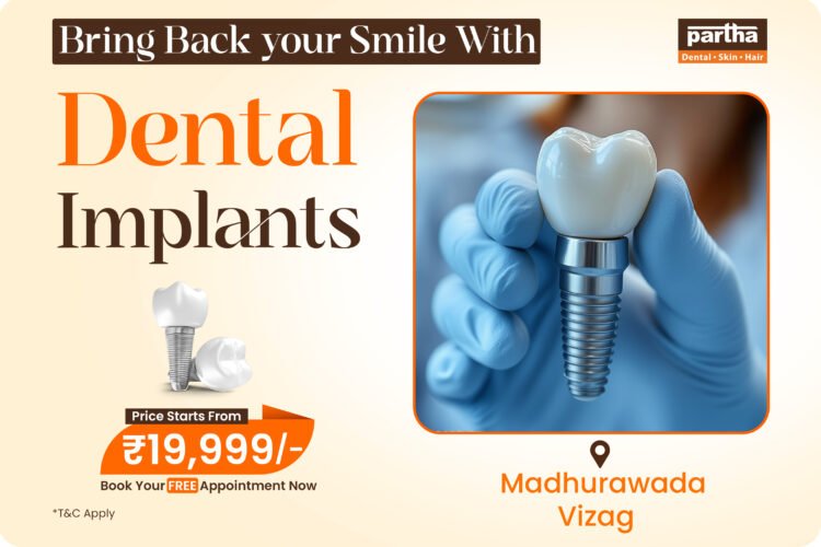 Dental Implants in Madhurawada