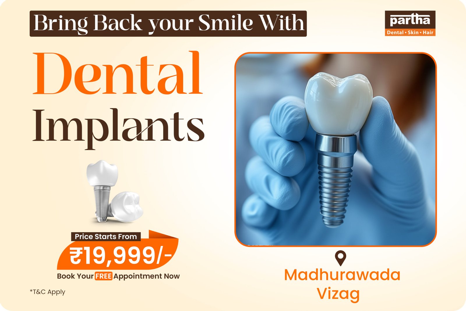Dental Implants in Madhurawada