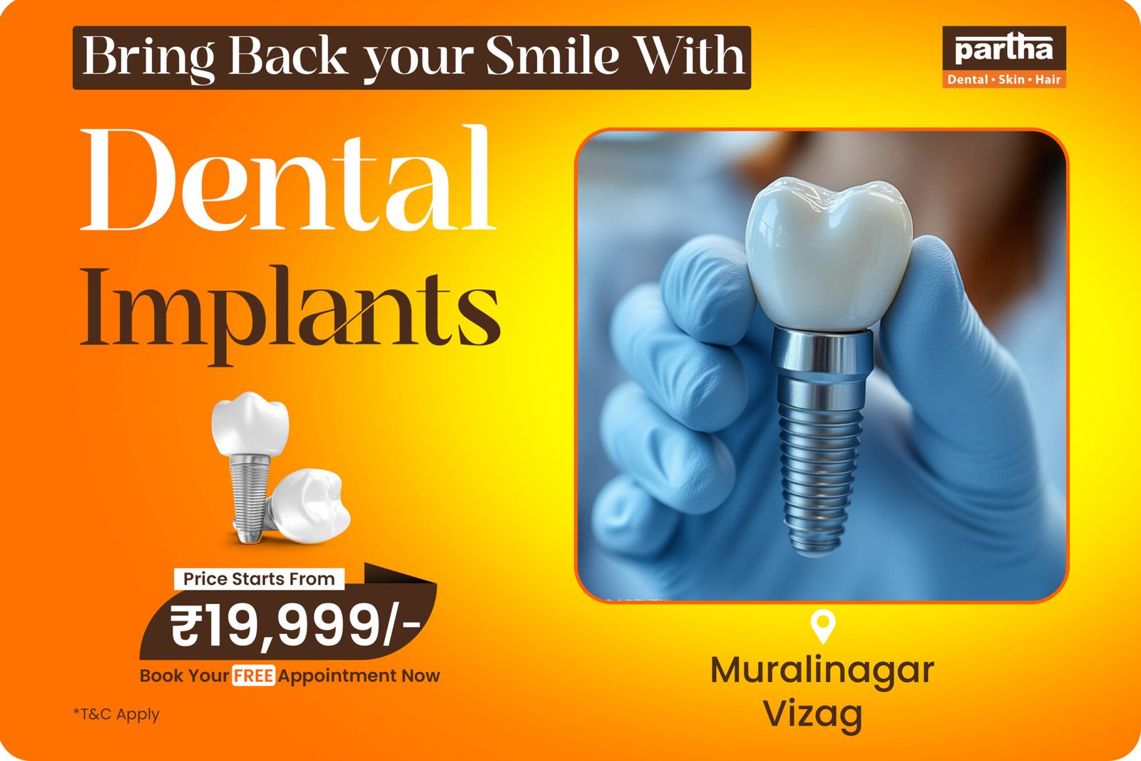 Dental Implants in Muralinagar