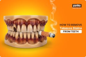 How to Remove Tobacco Stains from Teeth