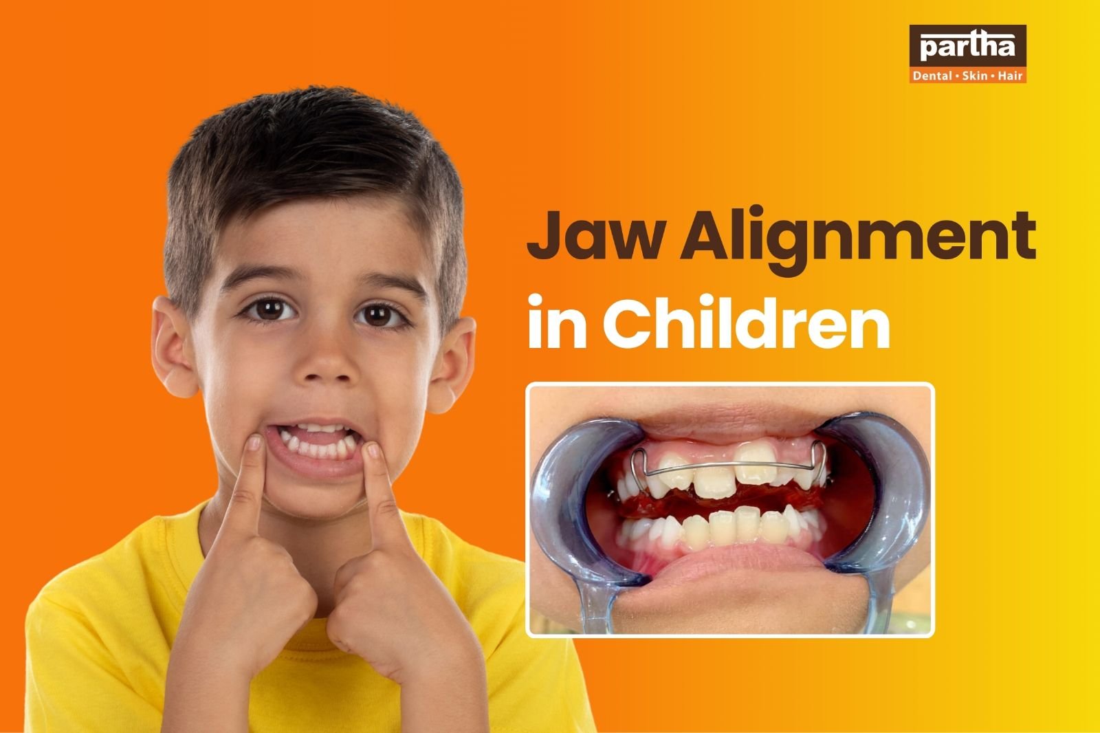Jaw alignment in children