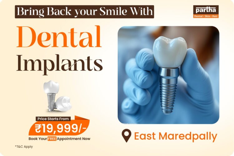 dental-implants-east maredpally