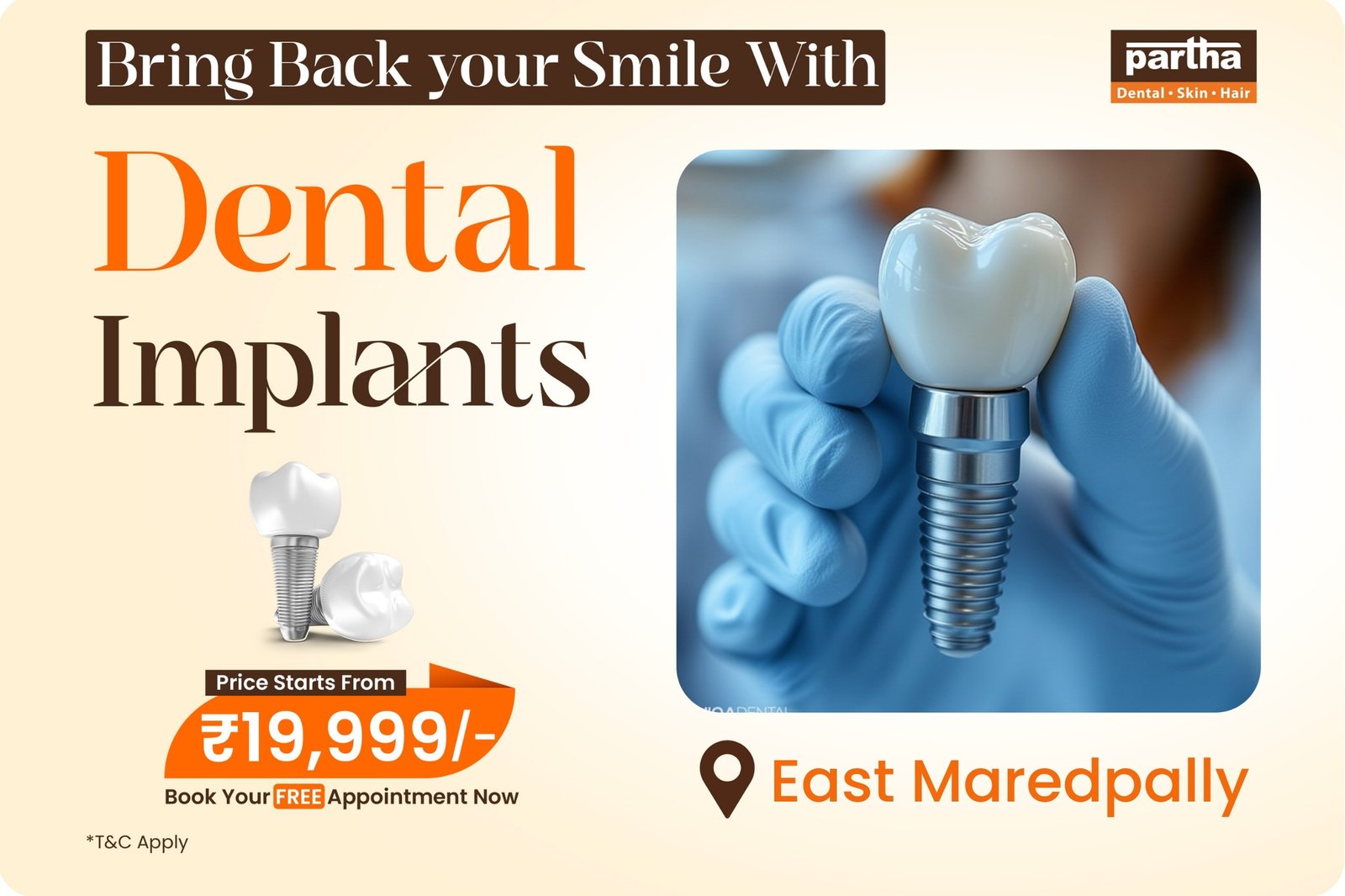 dental-implants-east maredpally