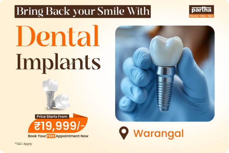 Dental-implants-warangal