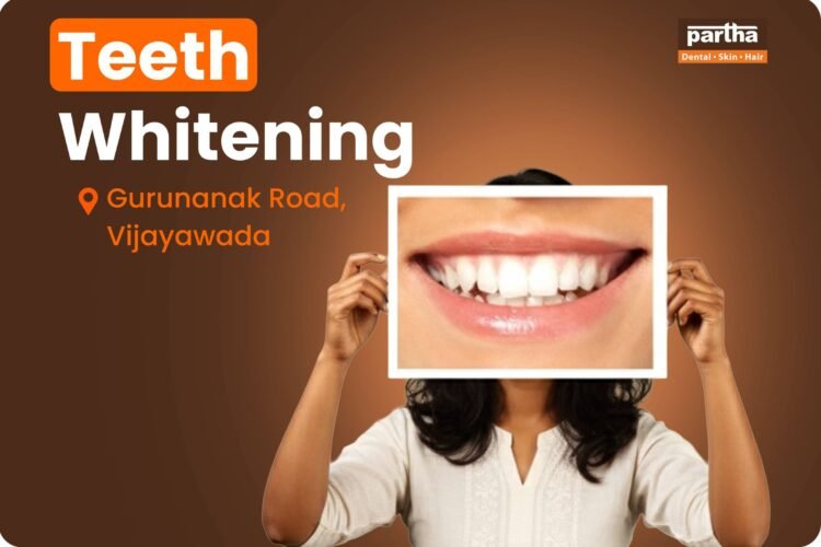 Teeth Whitening in Gurunanak Colony
