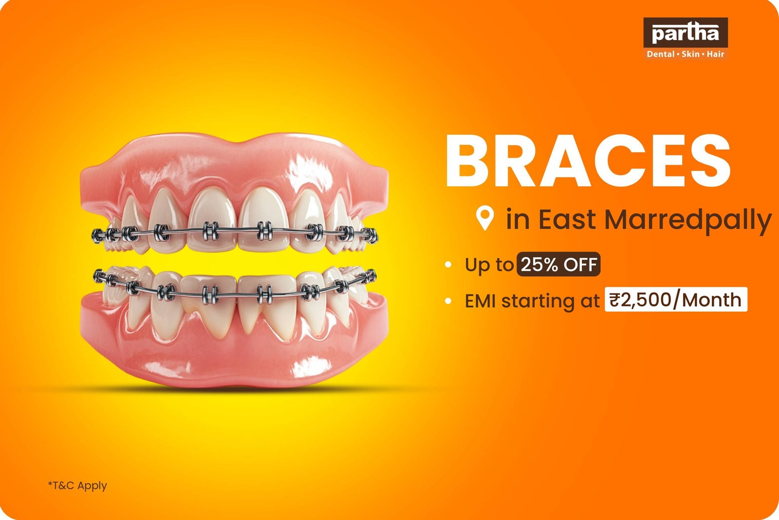Braces-East-Maredpally
