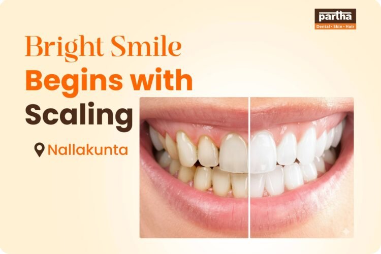 Teeth-scaling-nallakunta
