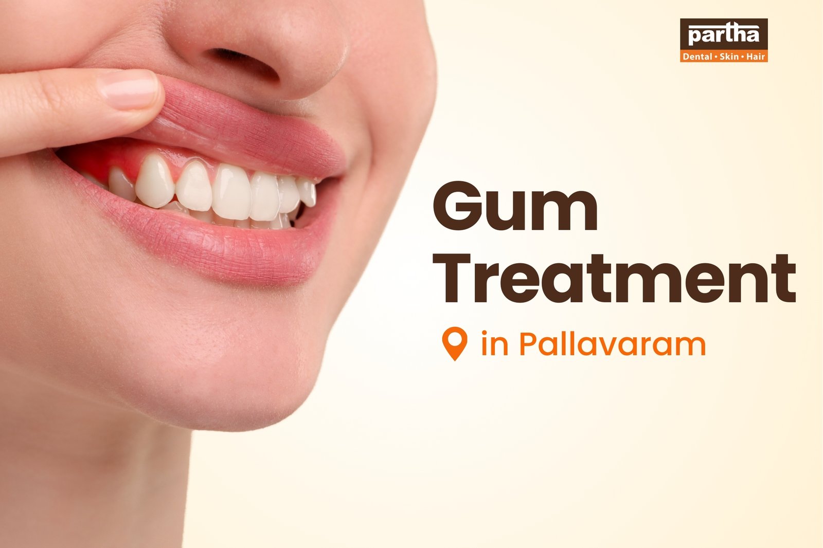 Best Gum Treatment in Pallavaram