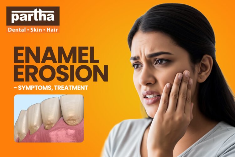 Enamel Erosion