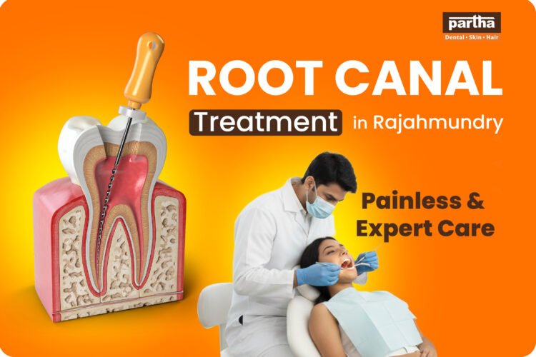 Root Canal Treatment in Rajahmundry