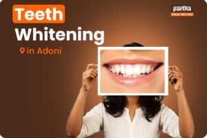 Teeth whitening in Adoni