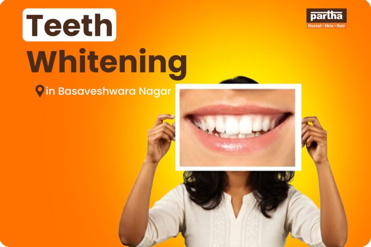 teeth whitening in Basaveswara Nagar