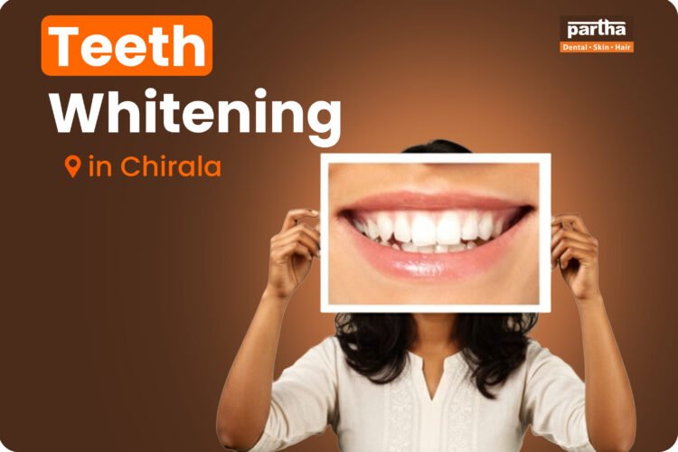 teeth whitening in chirala