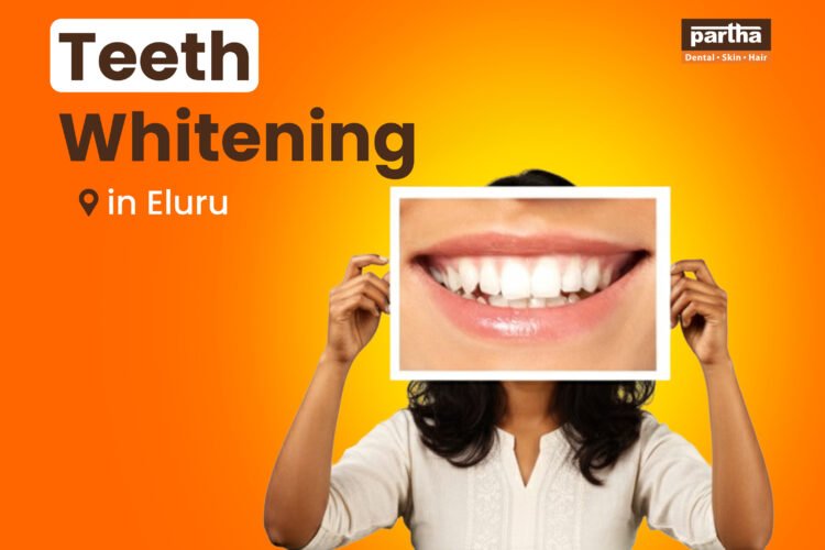 teeth whitening in eluru