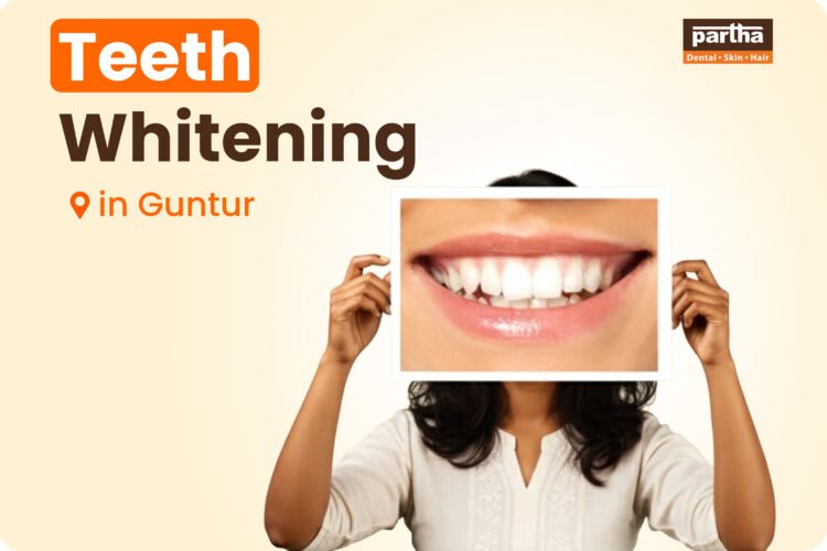 teeth whitening in guntur