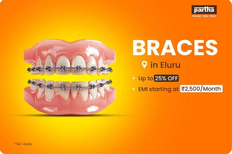 Tooth Braces Eluru