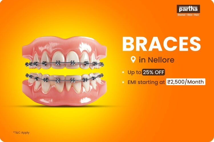 Tooth Braces in Nellore