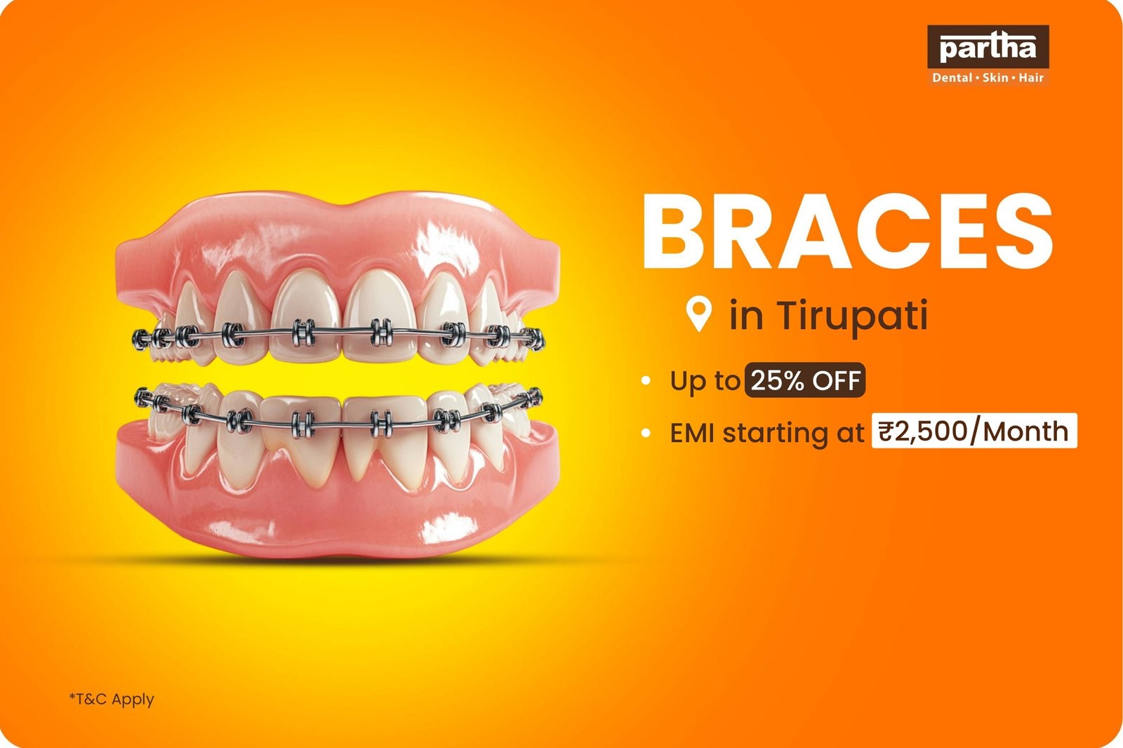 Tooth Braces in Tirupati