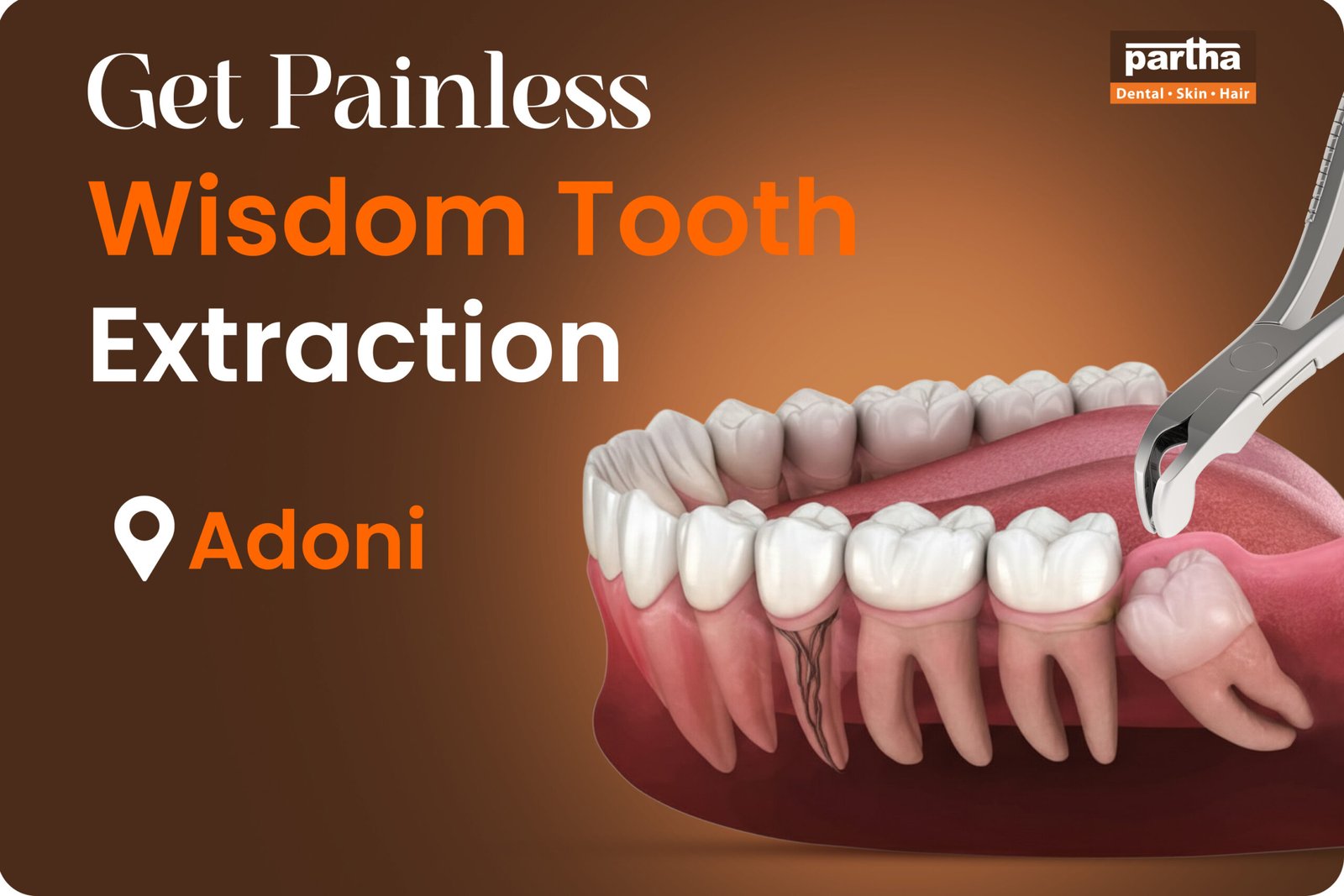 Wisdom Teeth Extarction Adoni