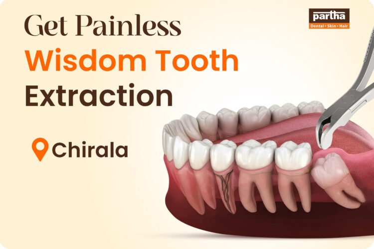 Wisdom Teeth Extarction Chirala