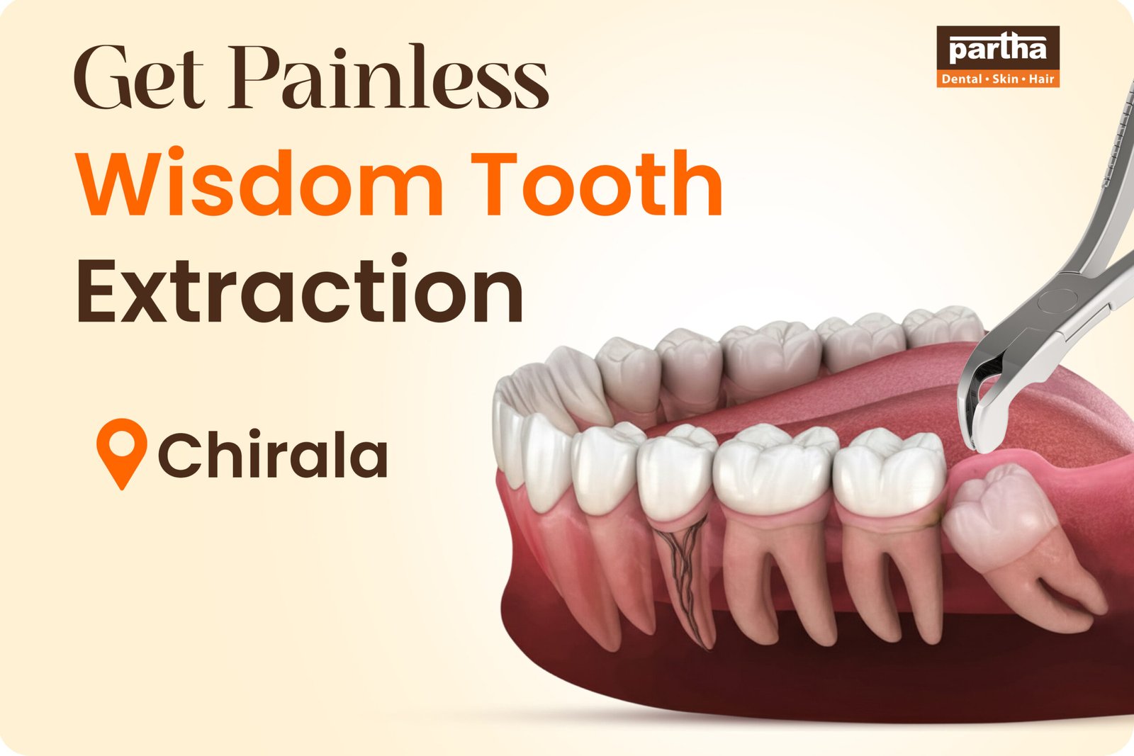 Wisdom Teeth Extarction Chirala