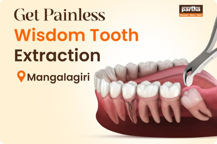Wisdom Teeth Extarction Mangalagiri