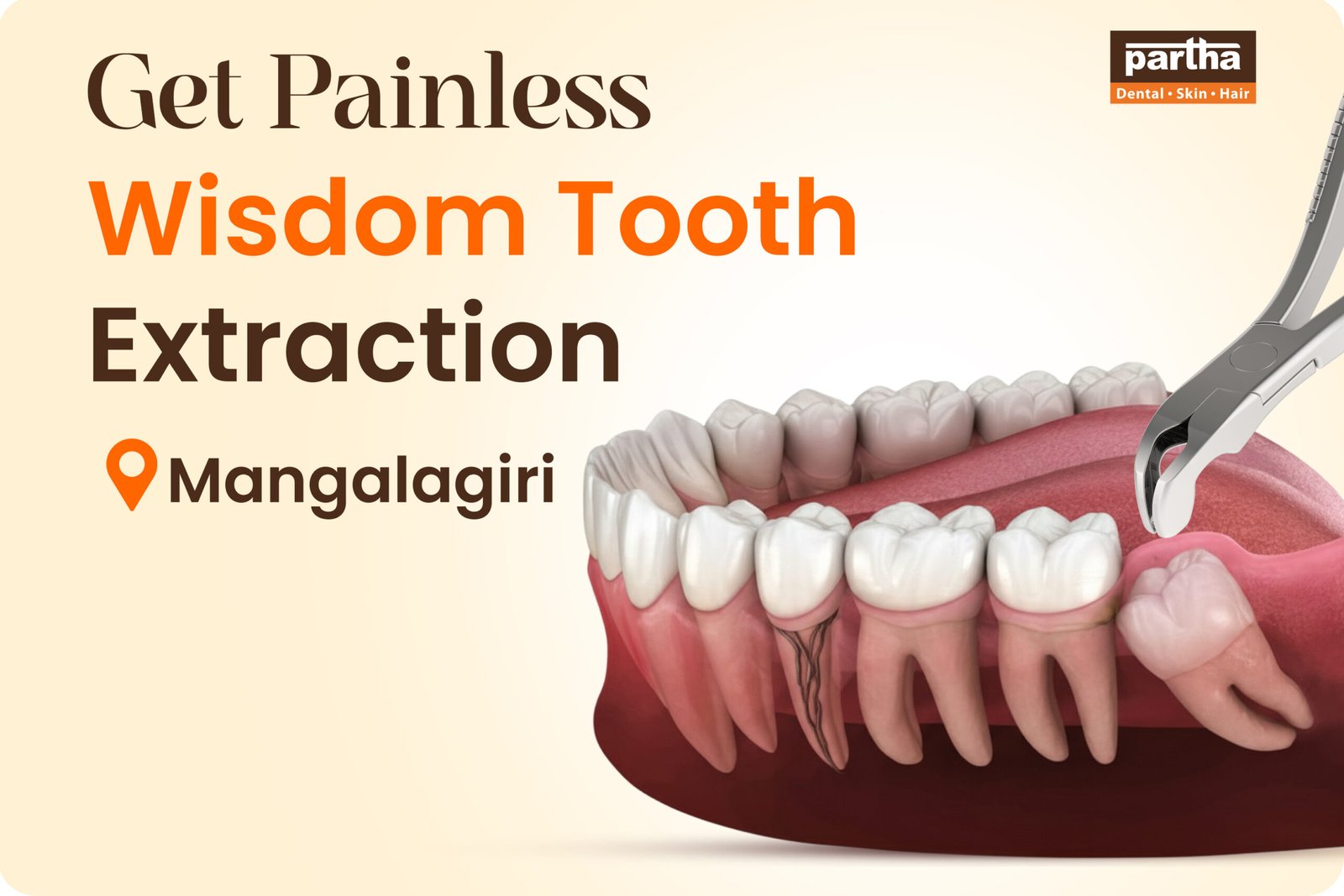 Wisdom Teeth Extarction Mangalagiri