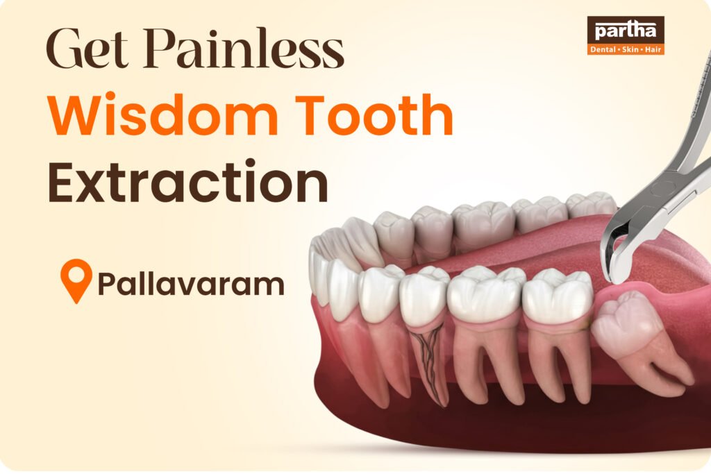 Wisdom Teeth Extraction In Pallavaram | Partha Dental