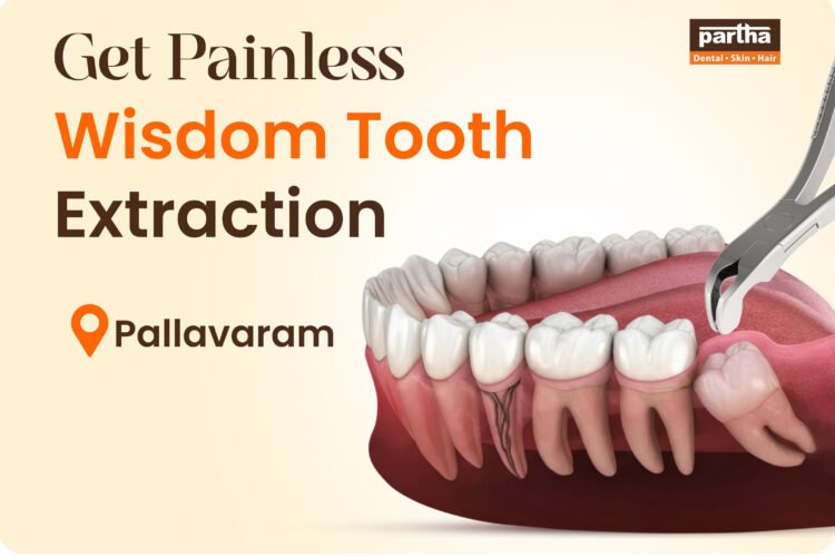 Wisdom Teeth Extarction Pallavaram
