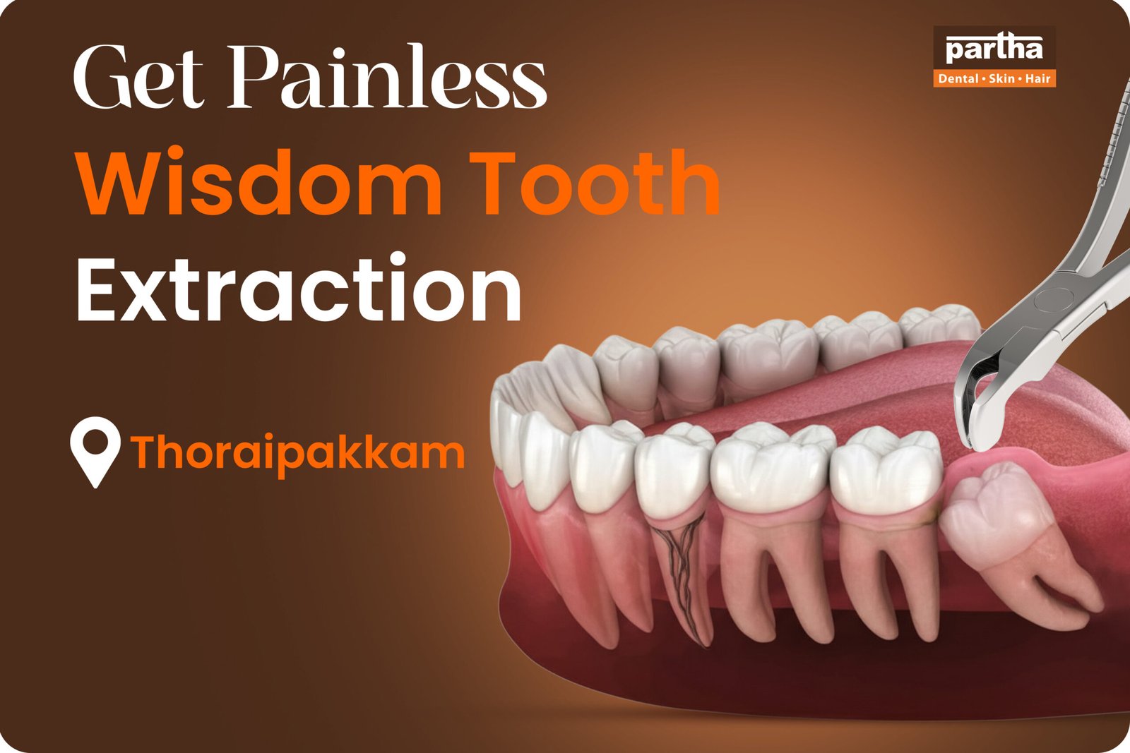 wisdom tooth removal in Thoraipakkam