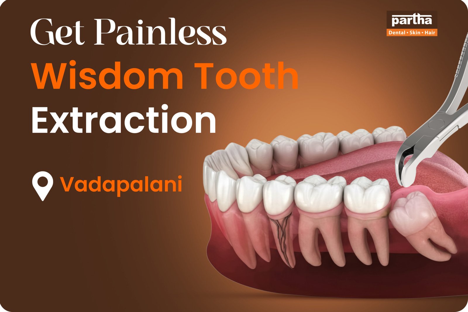 Wisdom Teeth Removal in Vadapalani